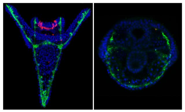 Sea urchins grow with deformities if in contact with chemicals from marine plastics, scientists from Cornwall have shown